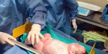 Nazarena, una bebé de 6,5 kilos, sorprende en Santiago del Estero: estado de salud de la madre e hija