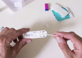 ¿Se realizó tu pareja el test de VIH? Un preocupante hallazgo sobre los mayores de 30 años y las tasas de positividad